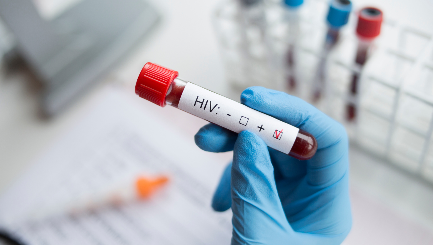 Testim për HIV. Foto: Foremniankowski në Canva